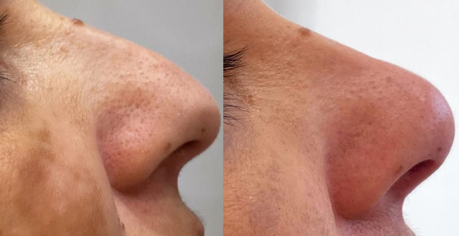 Prancheta 3 copiar 2