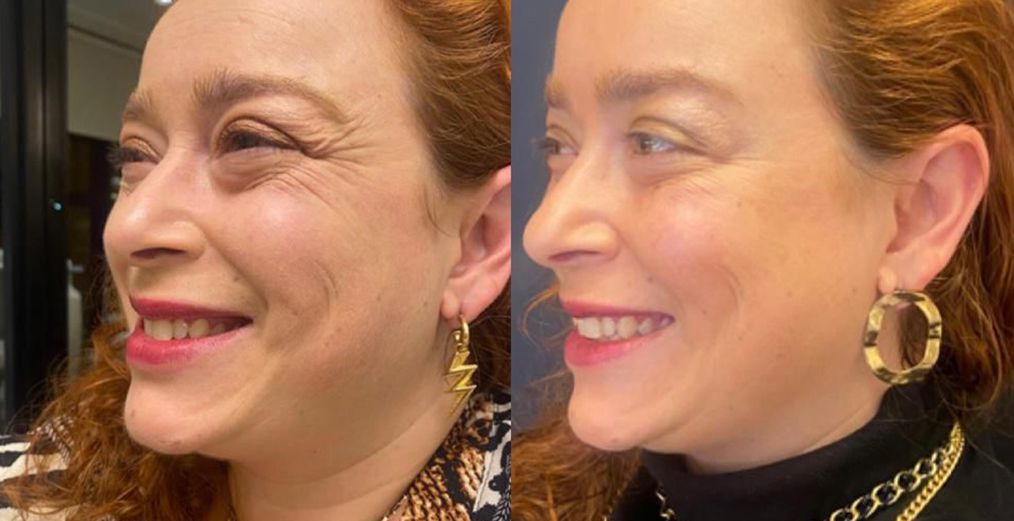 Prancheta 3 copiar 3