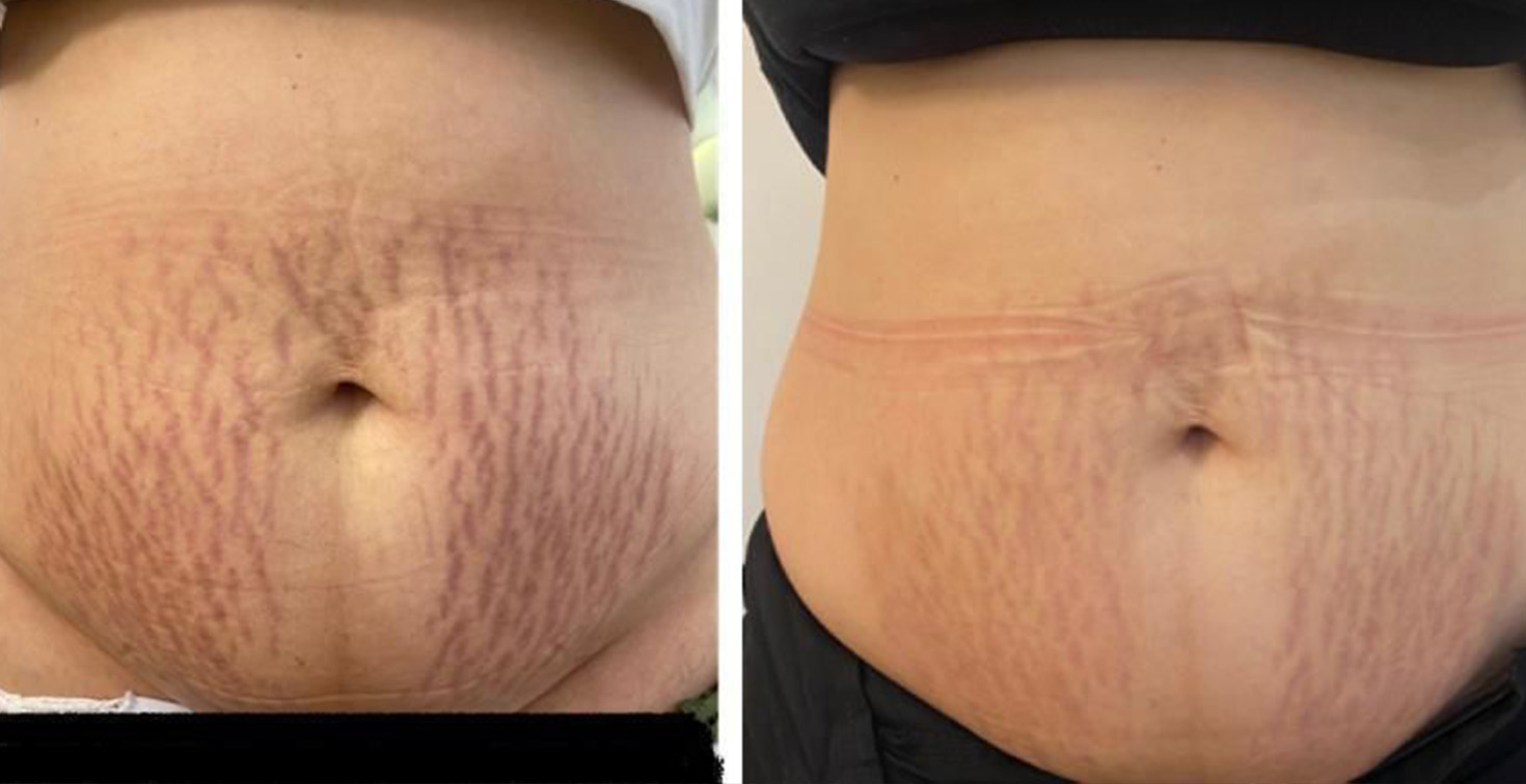 Prancheta 3 copiar 4